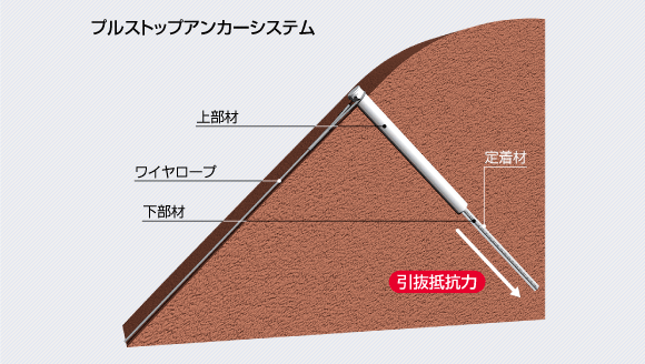プルストップアンカーシステム